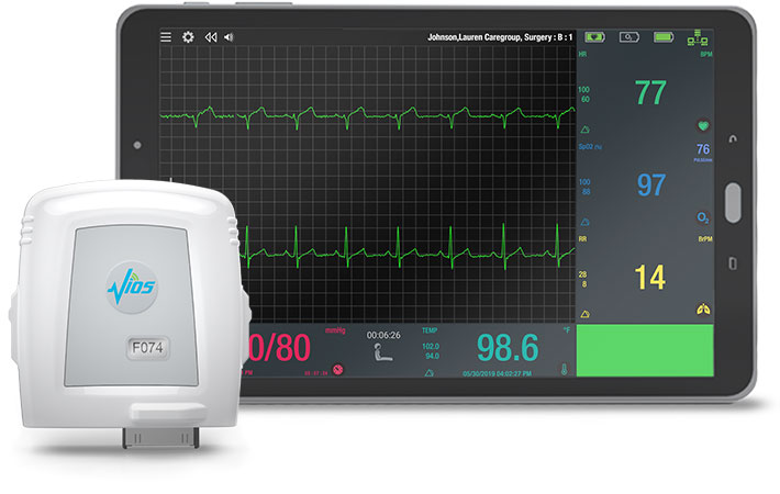 The Vios Chest Sensor and Bedside Monitor (BSM) Software