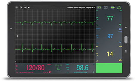 The Bedside Monitor (BSM) Software
