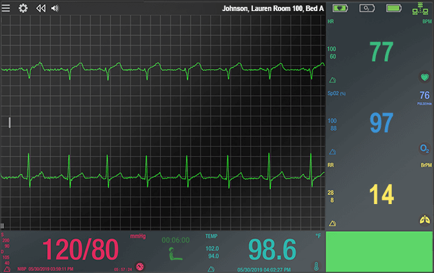 The Vios Bedside Monitor (BSM) Software