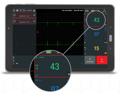 Vios Medical Cardiac